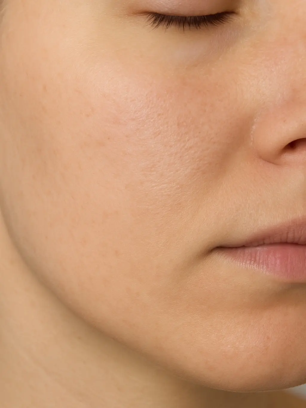 Patient photo after treatment, same angle and framing