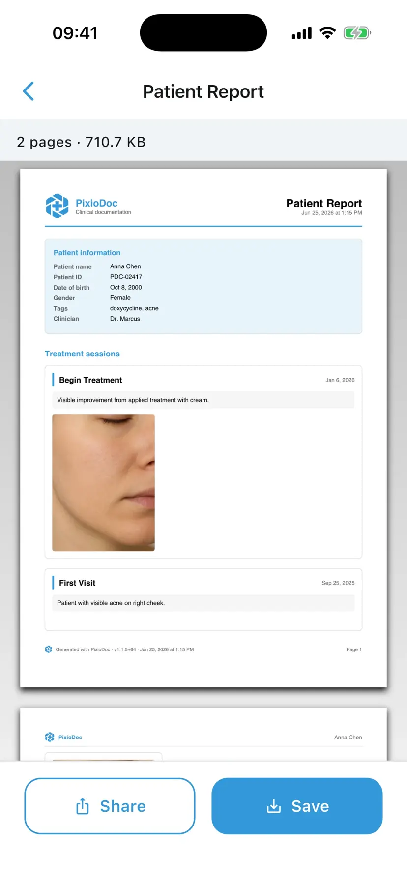 PixioDoc patient report screen showing PDF generation from selected sessions